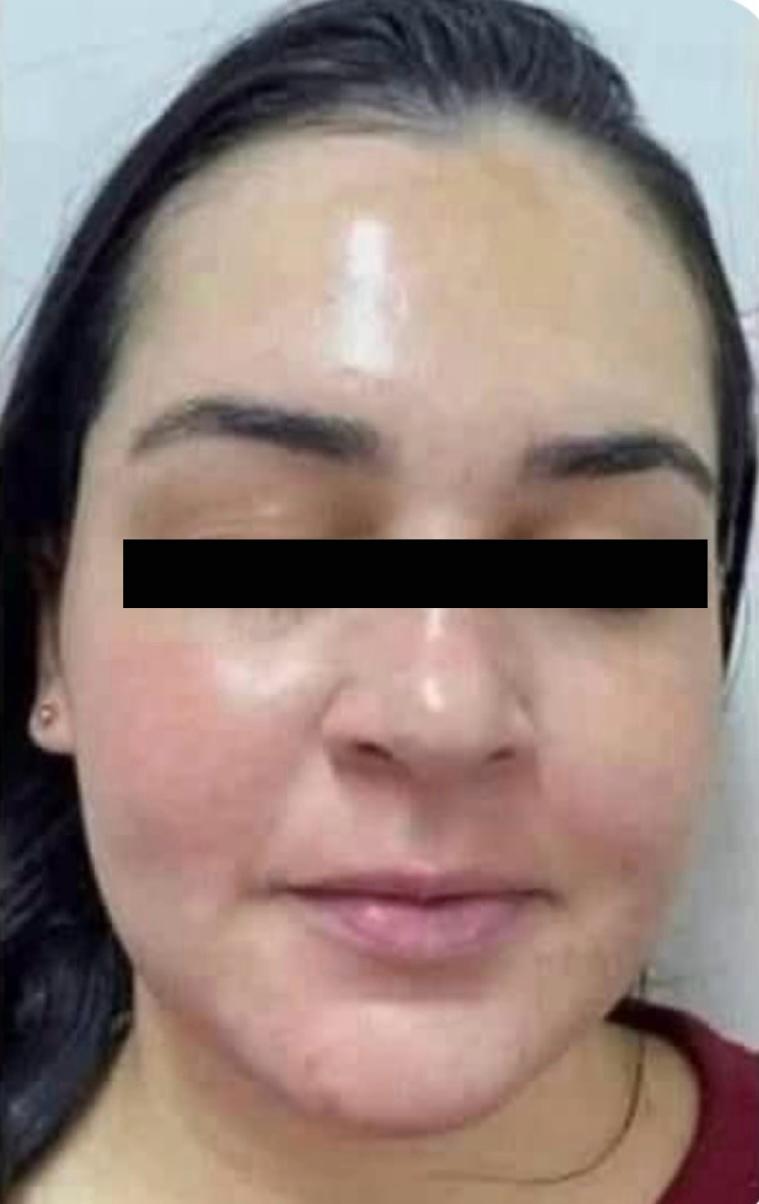 Danielle

 depois